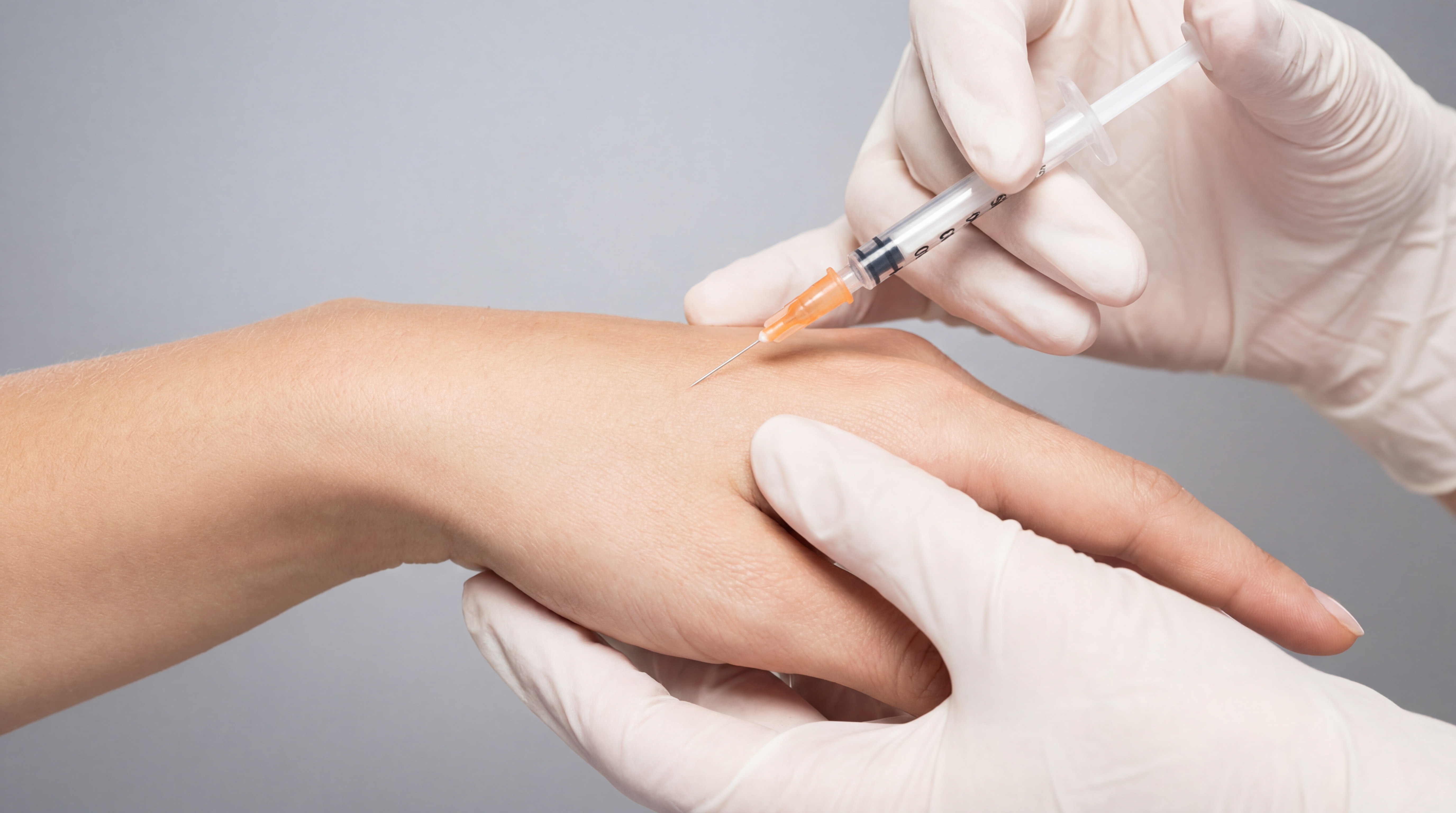 Botox Hands Treatment